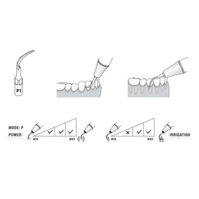 Woodpecker Scaler Tip P1 for UDS & EMS Scalers - Image 4